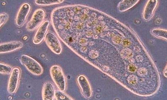 污水微生物处理技术